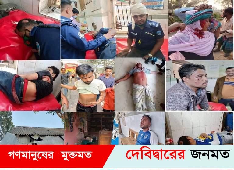 দেবীদ্বারে নির্বাচন সহিংসতায় ৪পুলিশসহ আহত ৩০,নারীসহ গেফতার-১২