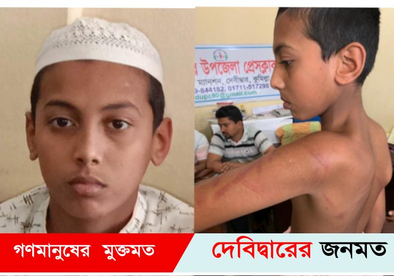 দেবীদ্বারে বড় হুজুর আমার বুকে পাড়া দিয়া ধইরা ২ বেত দিয়া পিটাইছে
